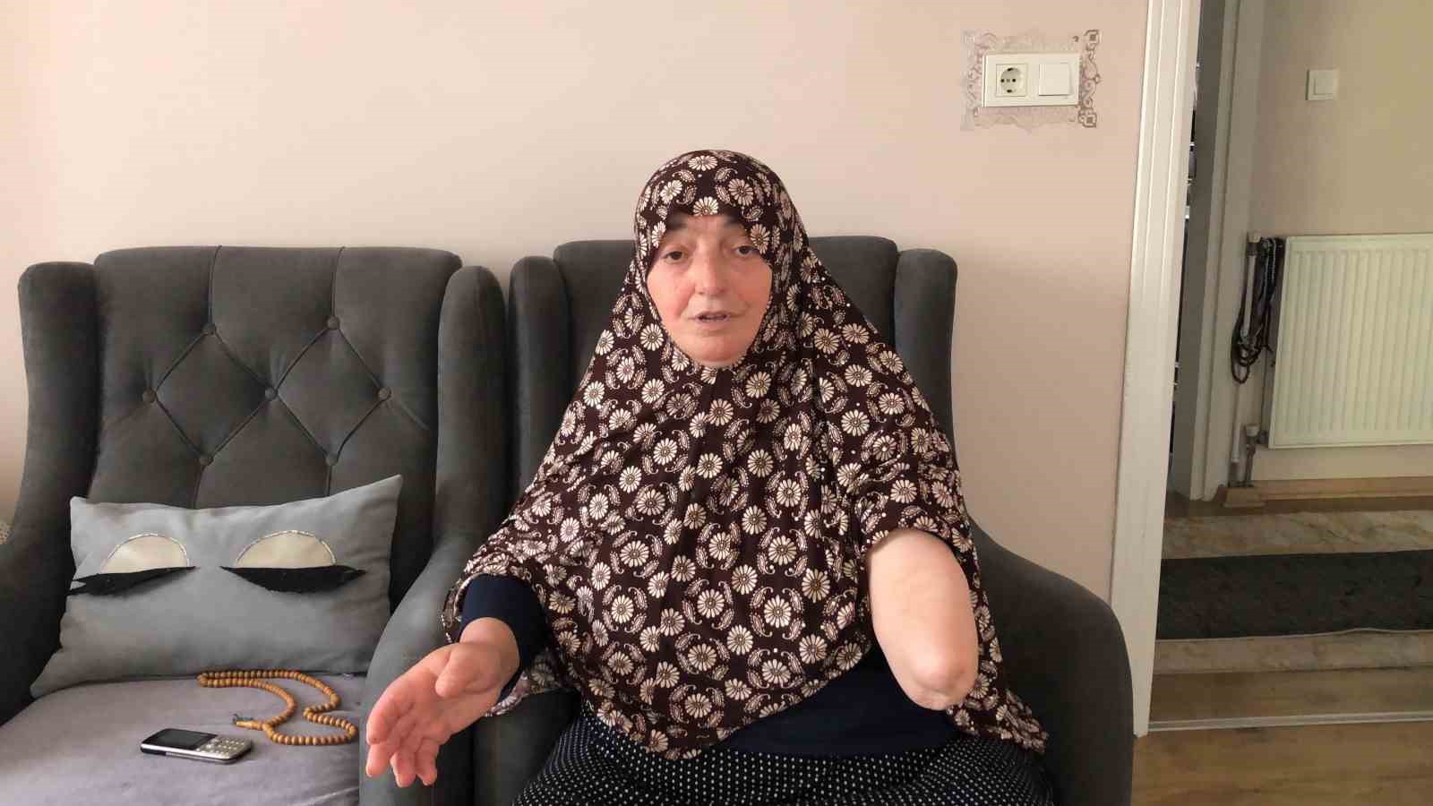 Köpekler kolunu parçaladı, gözleri açık gitti
